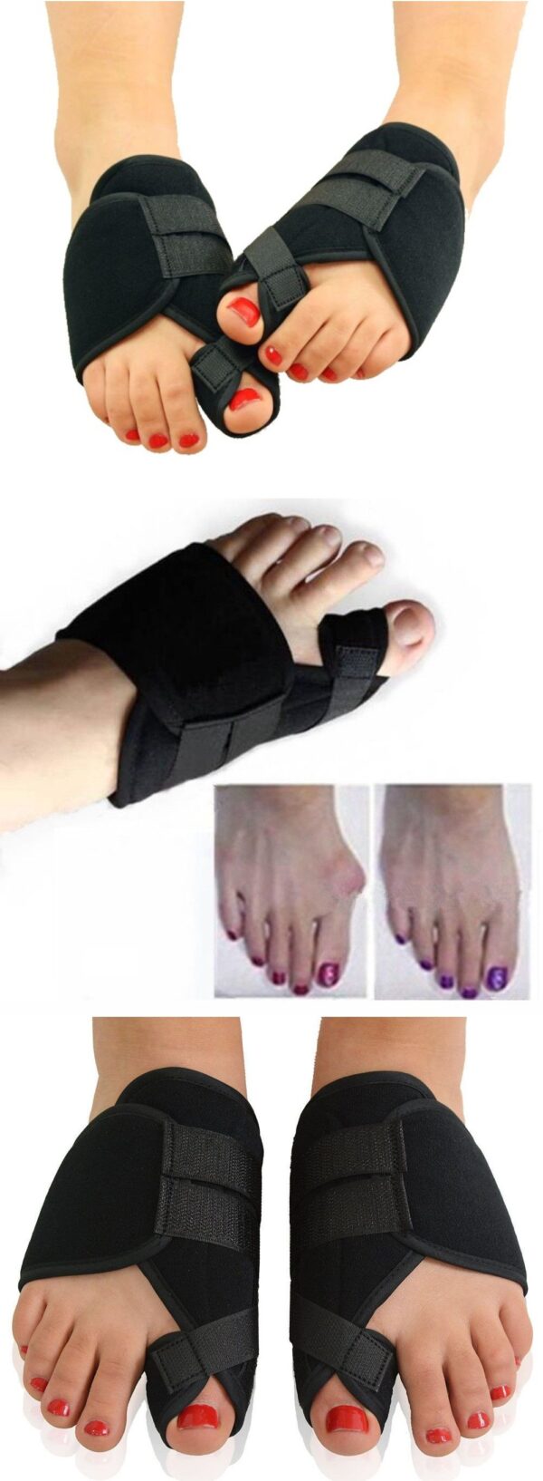 Protector – Corrector de Juanetes. Férula